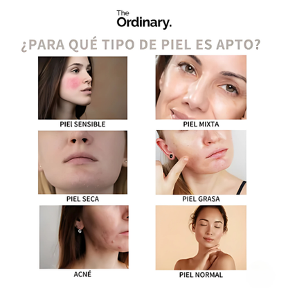 👑THE ORDINARY✨ Vitamina C: Potencia Antioxidante y Anti edad para tu Piel