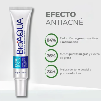 🌿CREMA ANTIACNÉ BIOAQUA💆‍♀️ Reduce Granos, Inflamación y Poros en pocos días”