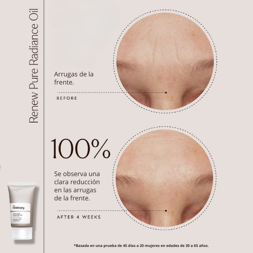 👑THE ORDINARY✨ Vitamina C: Potencia Antioxidante y Anti edad para tu Piel